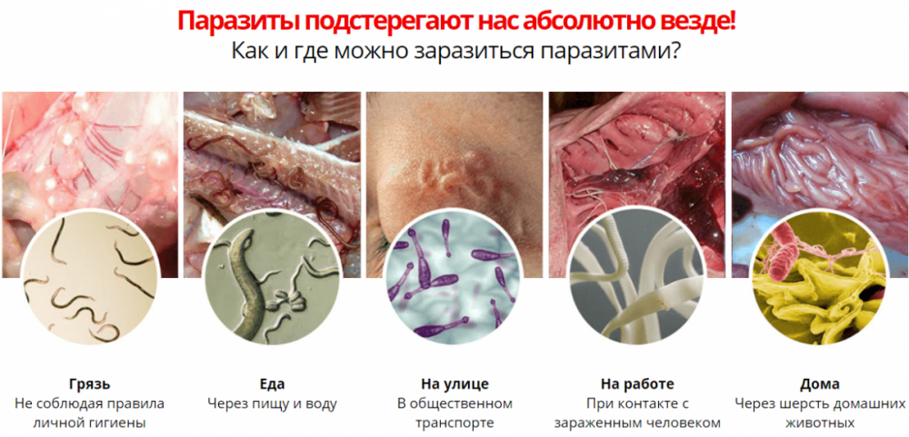 Паразиты